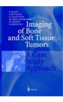 Imaging of Bone and Soft Tissue Tumors