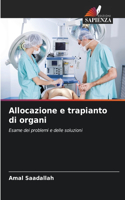Allocazione e trapianto di organi