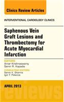 Saphenous Vein Graft Lesions and Thrombectomy for Acute Myocardial Infarction, an Issue of Interventional Cardiology Clinics, E-Book