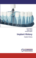 Implant History