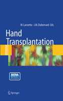 Hand Transplantation