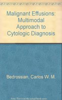 Malignant Effusions: Multimodal Approach to Cytologic Diagnosis