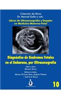 Diagnostico de Síndromes Fetales En El Embarazo, Por Ultrasonografia