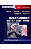 Image-Guided Interventions E-Book