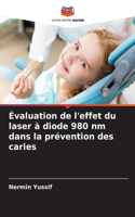 Évaluation de l'effet du laser à diode 980 nm dans la prévention des caries