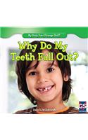Why Do My Teeth Fall Out?