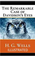 The Remarkable Case of Davidson's Eyes Illustrated