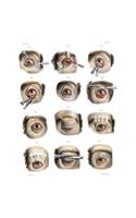 Corrective Eye Surgery for the Treatment of Blepharoptosis and Ectropion Composition Notebook