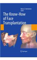 Know-How of Face Transplantation