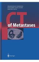 CT of Metastases