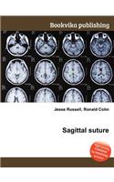 Sagittal Suture