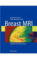 Breast MRI: Diagnosis and Intervention