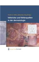 Fallstricke Und Fehlerquellen in Der Dermatologie