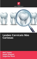 Lesões Cervicais Não Cariosas