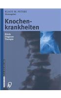 Knochenkrankheiten