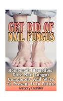 Get Rid Of Nail Fungus: Homemade Remedies That Cure Nail Fungus Completely And Ways To Prevent It In Future
