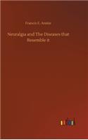 Neuralgia and The Diseases that Resemble it