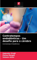 Contratempos endodônticos - Um desafio para o cérebro