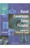 Dural Cavernous Sinus Fistulas