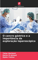 O cancro gástrico e a importância da exploração laparoscópica