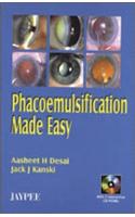 Phacoemulsification Made Easy (with 2 CD-ROMs)