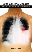 Lung Cancer & Diseases