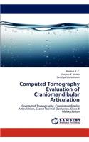 Computed Tomography Evaluation of Craniomandibular Articulation