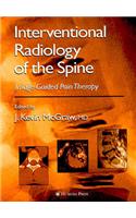 Interventional Radiology of the Spine
