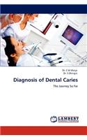 Diagnosis of Dental Caries