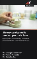 Biomeccanica nella protesi parziale fusa