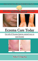 Eczema Cure Today - Get rid of Eczema forever natural ways to cure Eczema