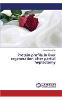 Protein profile in liver regeneration after partial heptectomy