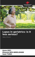 Lupus in geriatrics