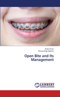 Open Bite and Its Management