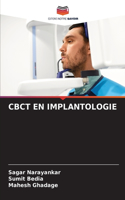 Cbct En Implantologie