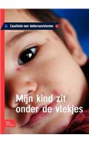 Mijn Kind Zit Onder de Vlekjes