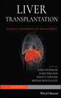 Liver Transplantation: Clinical Assessment and Management
