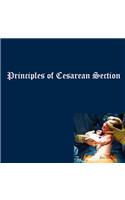 Principles of Cesarean Section