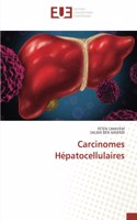 Carcinomes Hépatocellulaires