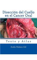 Diseccion del Cuello en el Cancer Oral