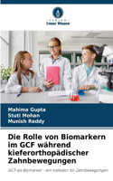 Rolle von Biomarkern im GCF während kieferorthopädischer Zahnbewegungen