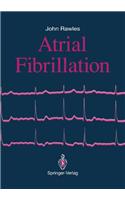 Atrial Fibrillation