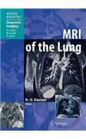 MRI of the Lung