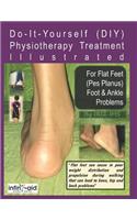 Physiotherapy Treatment Illustrated For Flat Feet (Pes Planus) Foot & Ankle Problems