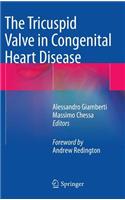 The Tricuspid Valve in Congenital Heart Disease