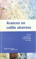 Avances en colitis ulcerosa