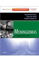 Meningiomas E-Book