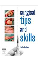 Surgical Tips and Skills