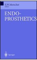 Endoprosthetics