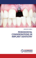 Periodontal Considerations in Implant Dentistry